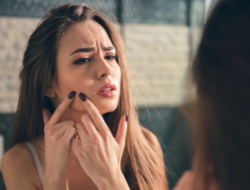 pattanás, miteszer, gyógynövény, arcápolás