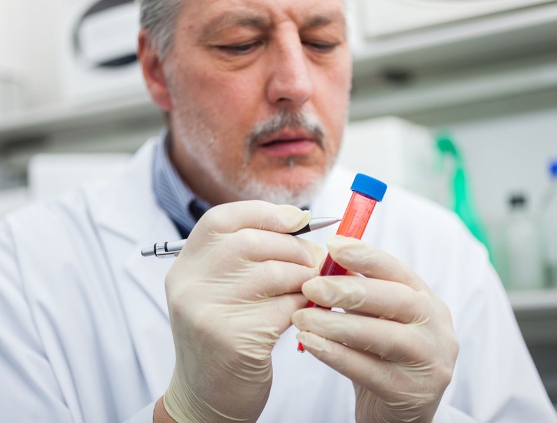 Parkinson-kór legkorábbi jele vérből