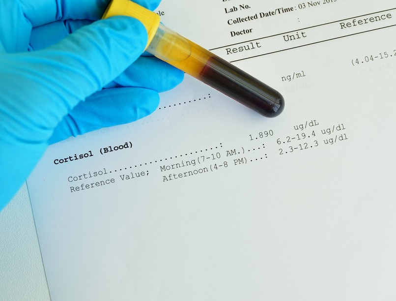 Mit jelent kortizol érték laborlelet