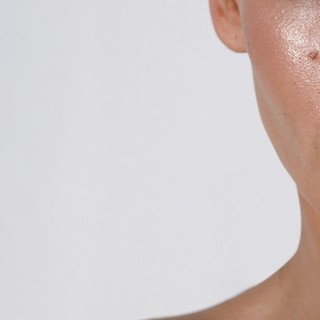 Mire utal a fokozott bőrzsírosodás? című cikk nyitóképe