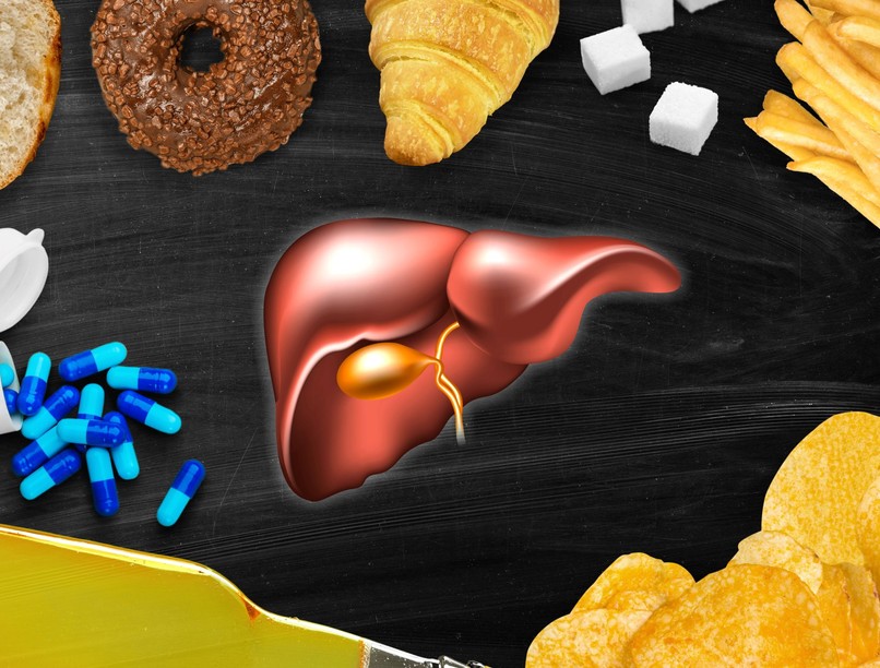 májkárosodás zsírmáj ellen melyik ásványi anyag