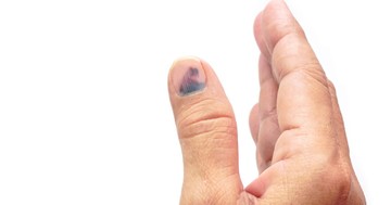  Csak szépséghiba, vagy komoly baj? Ezt árulhatják el a körmei az egészségéről 