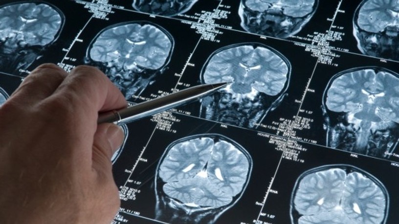 brain-scan