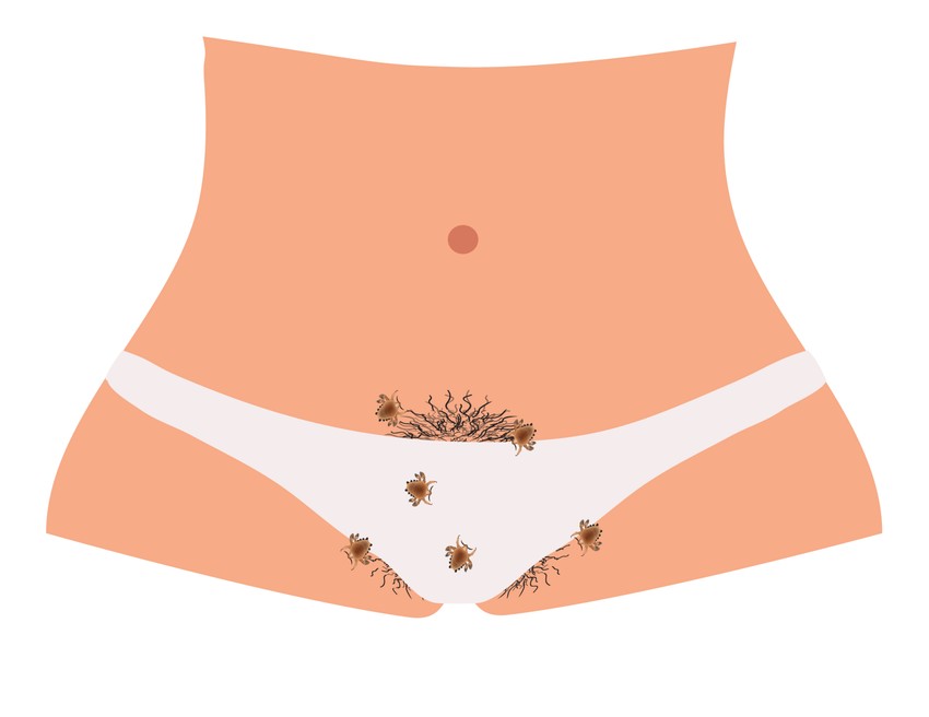 A lapostetvek a fanszőrzetben, ritkábban a hónalj, a hasfal és a végtagok szőrzetében élnek a szőrszálak tövénél a bőrbe fúródva, vagy a szőrszálba kapaszkodva, illetve a szempillák, szemöldökszálak tövénél is láthatóak időnként serkéi, főleg gyermekek esetében.