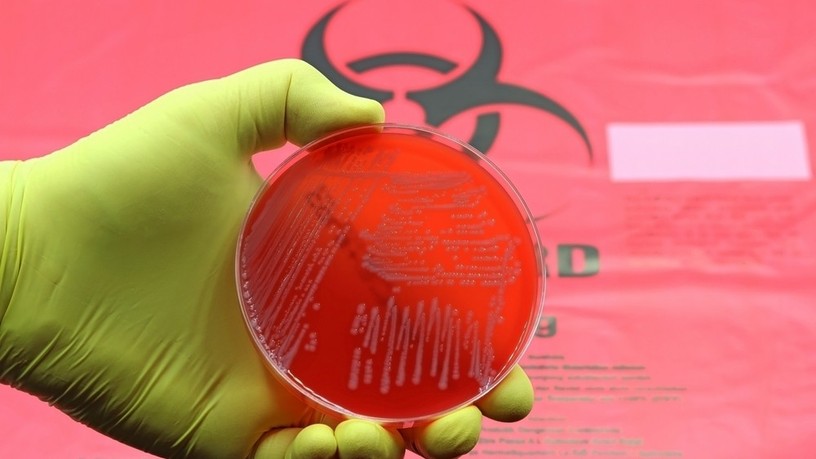 Acinetobacter baumannii antibiotikum rezisztencia AI