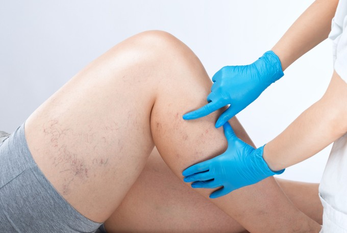 Hetek óta nem gyógyul a sebe? Ezt a jelet sokan elbagatellizálják, pedig nem kellene című cikk nyitóképe