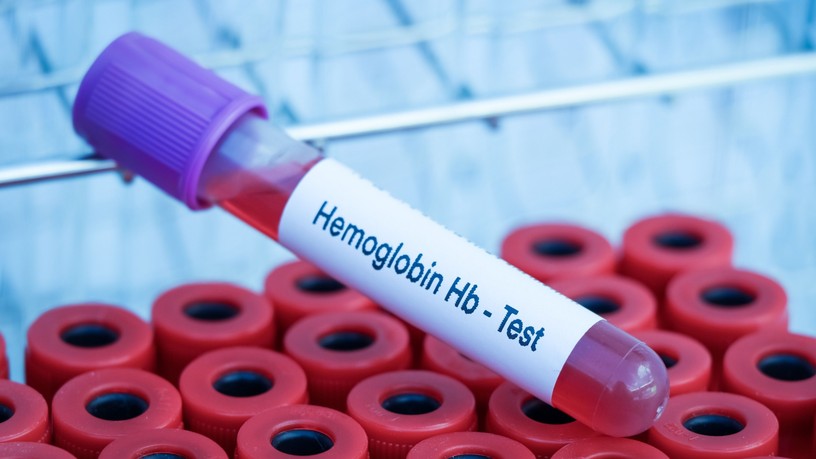 orvos válaszol alacsony hemoglobin kezelés