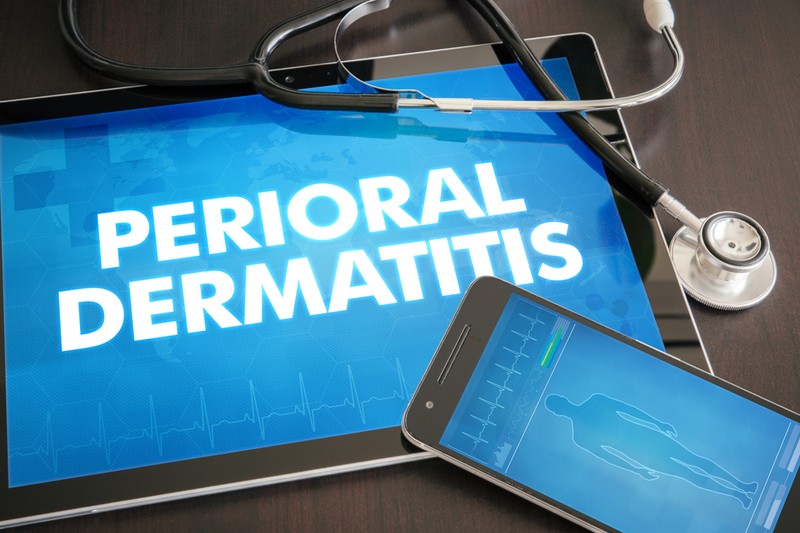 Periorális dermatitisz oka, tünetei és kezelése