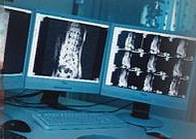 Közérdekű: éjszakai MRI-vizsgálatok rendkívüli alkalommal