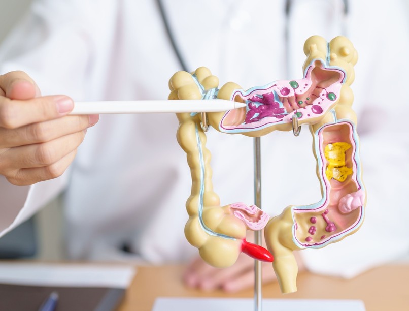 mitől alakul ki polip