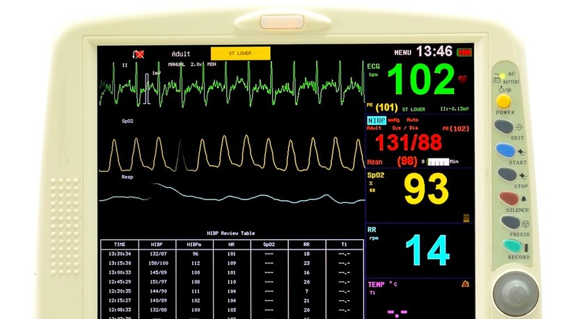 ekg_otthon