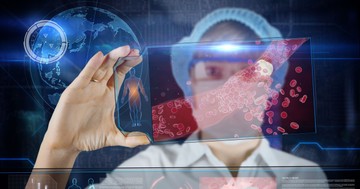  Mit kell tenni érelmeszesedés esetén? Ezeket igya, egye és tegye! 