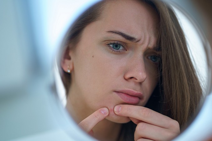 A bőrrák kezdeti tünetét sokan pattanásnak, apró sérülésnek nézik című cikk nyitóképe