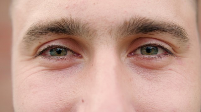 Ha begyulladt a szeme, és ilyen kísérőtünetei vannak, ne halogassa az az orvost!