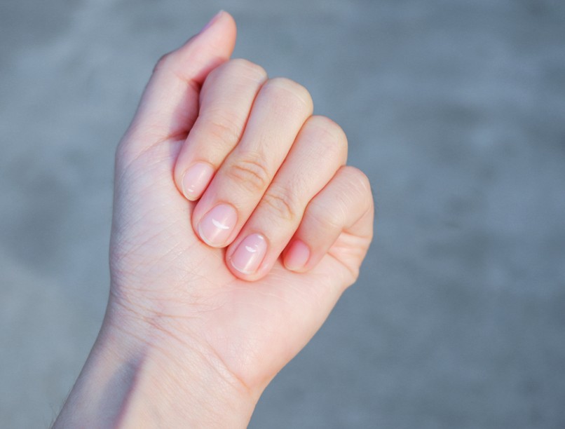 beau-vonal, köröm, elváltozás, koronavírus tünet, covid-köröm