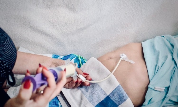 Sok beteg számára egy-egy adott időszakban, illetve egészségi állapotban a táplálásterápia, és ezen belül a szondatáplálás jelenti az életminőség-javulás esélyét.