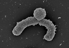 Közönséges, mint a piszok? Egy szenzációs új antibiotikum nyomában