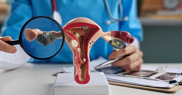  Milyen egy PCOS-vizsgálat? Lépésről lépésre: erre számíthat, ha felmerül a policisztás ovárium szindróma gyanúja 