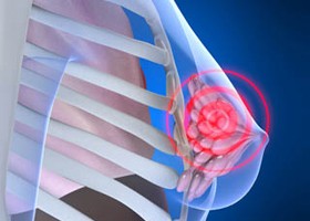 Fontos! A leggyakoribb rákkeltő anyagok listája