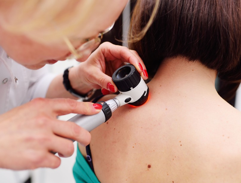 melanóma megelőzés kampány fényvédelem Euromelanoma 