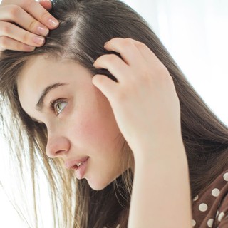 Foltos hajhullás - bár teljesen meggyógyítani nem lehet, de sokat tehet ellene című cikk nyitóképe