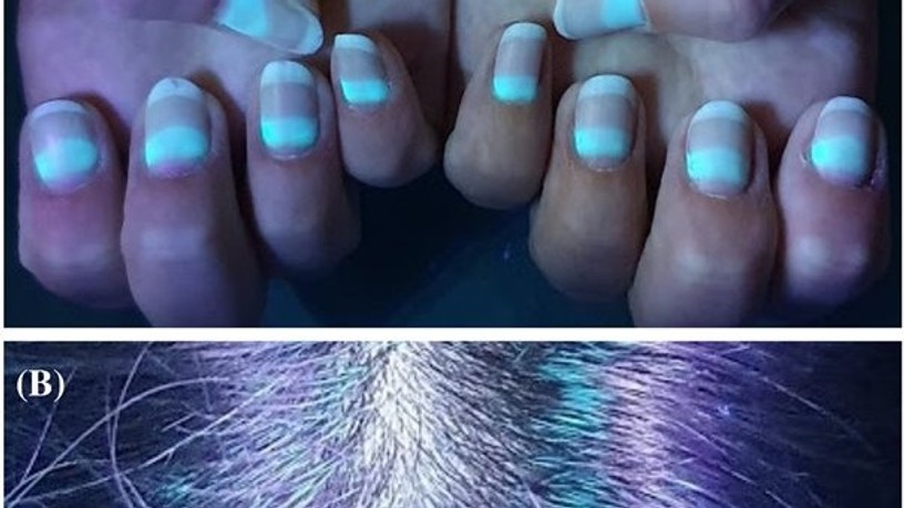 favipiravir mellékhatása, koronavírus, fluoreszkálás