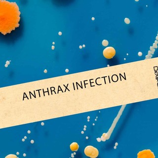 Anthrax (lépfene): tünetei, vizsgálata és a kezelési lehetőségei című cikk nyitóképe