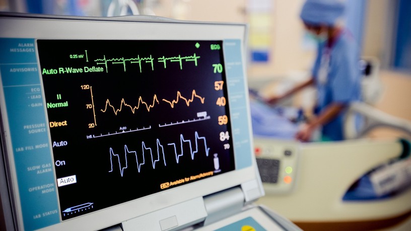 terheléses EKG vizsgálat típus melyik szükség