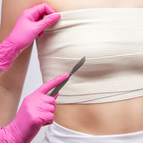 Melleltávolítás és rekonstrukciós műtét után lehet még TB alapon további beavatkozást kérni? Az orvos válaszol című cikk nyitóképe