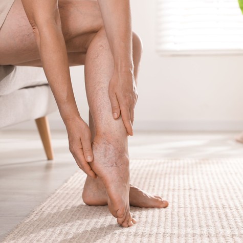 Visszértorna: ez a mozgás a legjobb „vénagyógyszer” a gyógytornász szerint című cikk nyitóképe