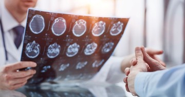 Nem csak fejfájás: 12 meglepő tünet, ami agydaganat jele is lehet