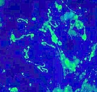 Leptospirózis - helyzetkép