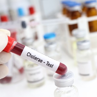 Kolera: tünetei, vizsgálata és kezelési lehetőségei című cikk nyitóképe