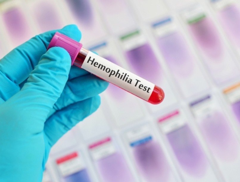 hemofilia-teszt