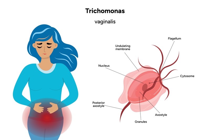 Trichomonas-fertőzés tünetei, vizsgálata és kezelési lehetőségei