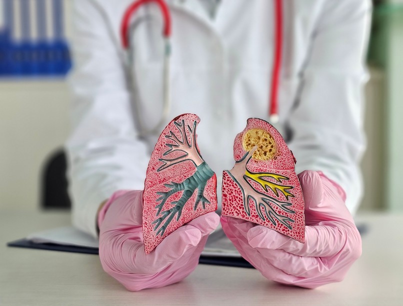 Hörghurut tünet vizsgálat kezelés