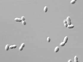 Dilemma: Pneumococcus-elleni védőoltás