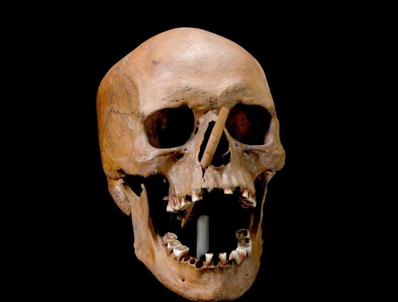 DNS, csontok, vizsgálat, dánia