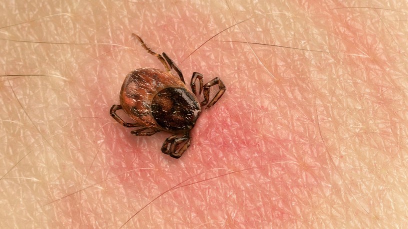lyme-kór krónikus tünetei