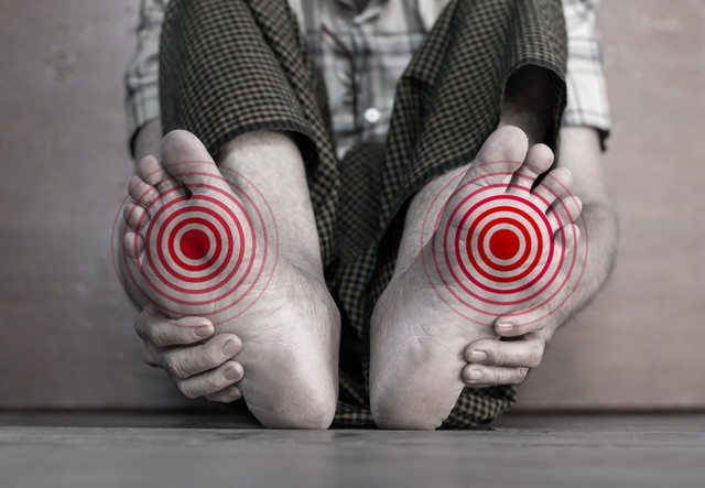 Diabéteszes láb szindróma: ilyen tünetekkel jár, ha a vércukor miatt károsodnak az erek