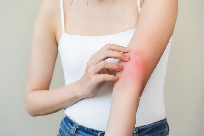 Gyermekek tízezreit érinti Magyarországon – így rontja az életminőséget az atópiás dermatitisz című cikk nyitóképe