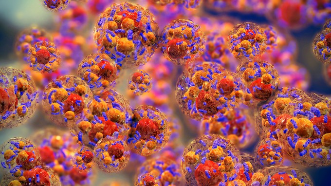 Mi jó zsírmáj ellen? Ezeket a házi módszereket érdemes kombinálni című cikk nyitóképe