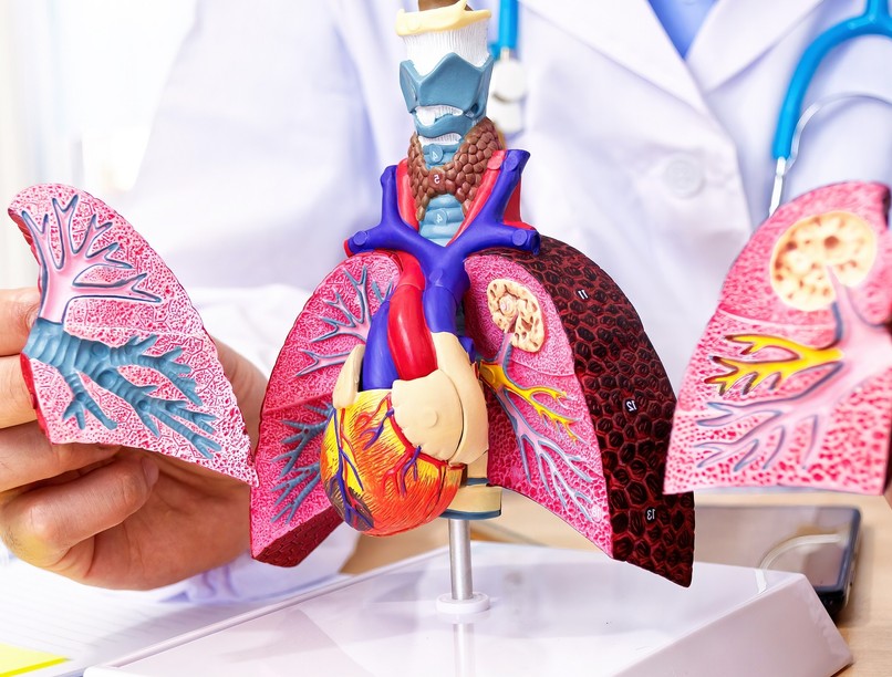 tüdőtranszplantáció tüdő átültetés kezelés leírás