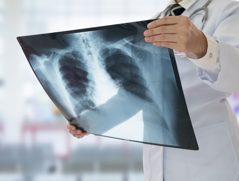 köhögés tüdőgyulladás hőemelkedés láz nehézlégzés