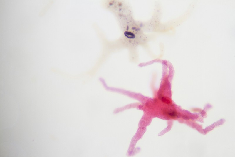 Veszélyes agyevő amőba ellen találtak megoldást a kutatók