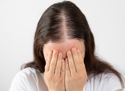 Hajhullás és kopaszodás nőknél: ezt teheti ellene című cikk nyitóképe