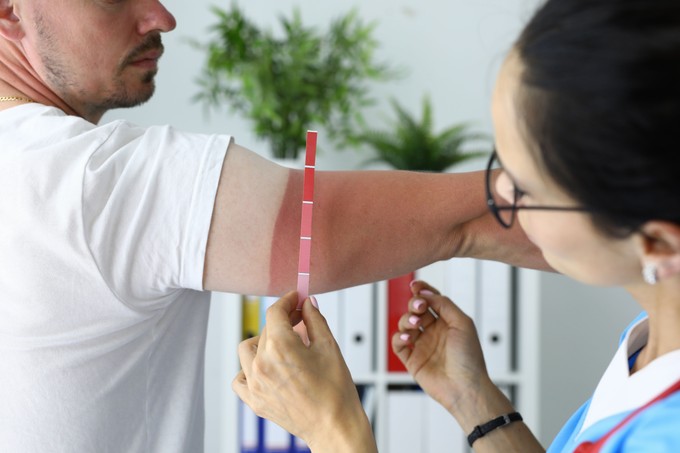 6 tanács a bőrgyógyásztól - így védekezzen a nap káros sugarai ellen című cikk nyitóképe