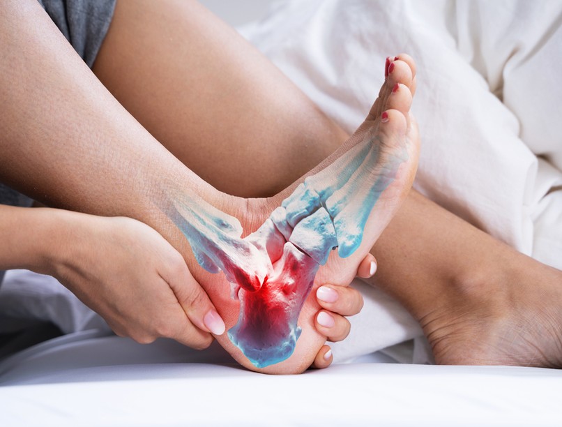 boka, bokaficam, bokarándulás, bokaszalag szakadás, rándulás, terápia,