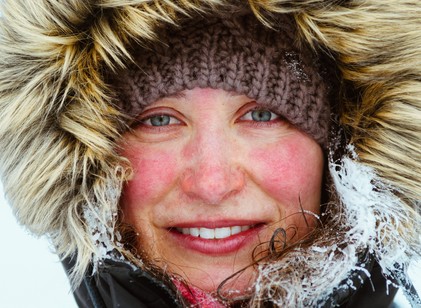 Miért pirosodik ki az arcunk, amikor melegünk van vagy fázunk? című cikk nyitóképe