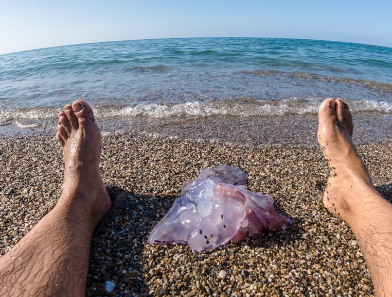 medúza medúzacsípés, vizelet, pisilés